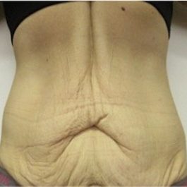 Before-8 x Treatments�