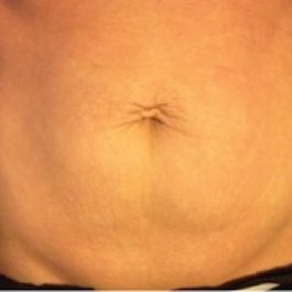 After-8 x Treatments�
